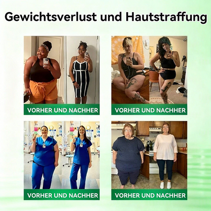 【Offizieller Shop】| 🍃 Healrize® Moringa · Berberin × NAD+ 10-in-1 Advanced Nano-Mikronadel-Pflaster Nicht-invasiv✔️Bei Fettleibigkeit, schlaffer Haut, Diabetes, Schlafapnoe, Gelenkproblemen und vielem mehr