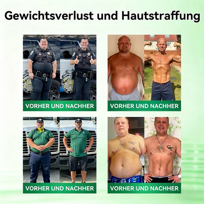 【Offizieller Shop】| 🍃 Healrize® Moringa · Berberin × NAD+ 10-in-1 Advanced Nano-Mikronadel-Pflaster Nicht-invasiv✔️Bei Fettleibigkeit, schlaffer Haut, Diabetes, Schlafapnoe, Gelenkproblemen und vielem mehr