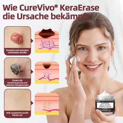 CureVivo®  Erhalten Sie 80 % Rabatt beim Hinzufügen eines zweiten Artikels
